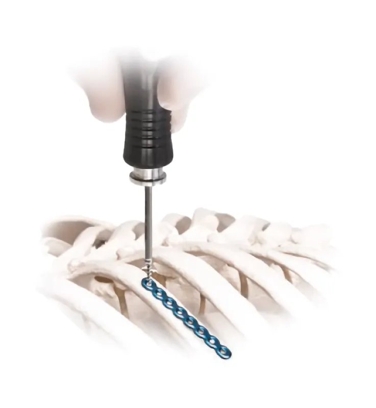 herramientas de fijación temporal ribfix blu de zimmer biomet