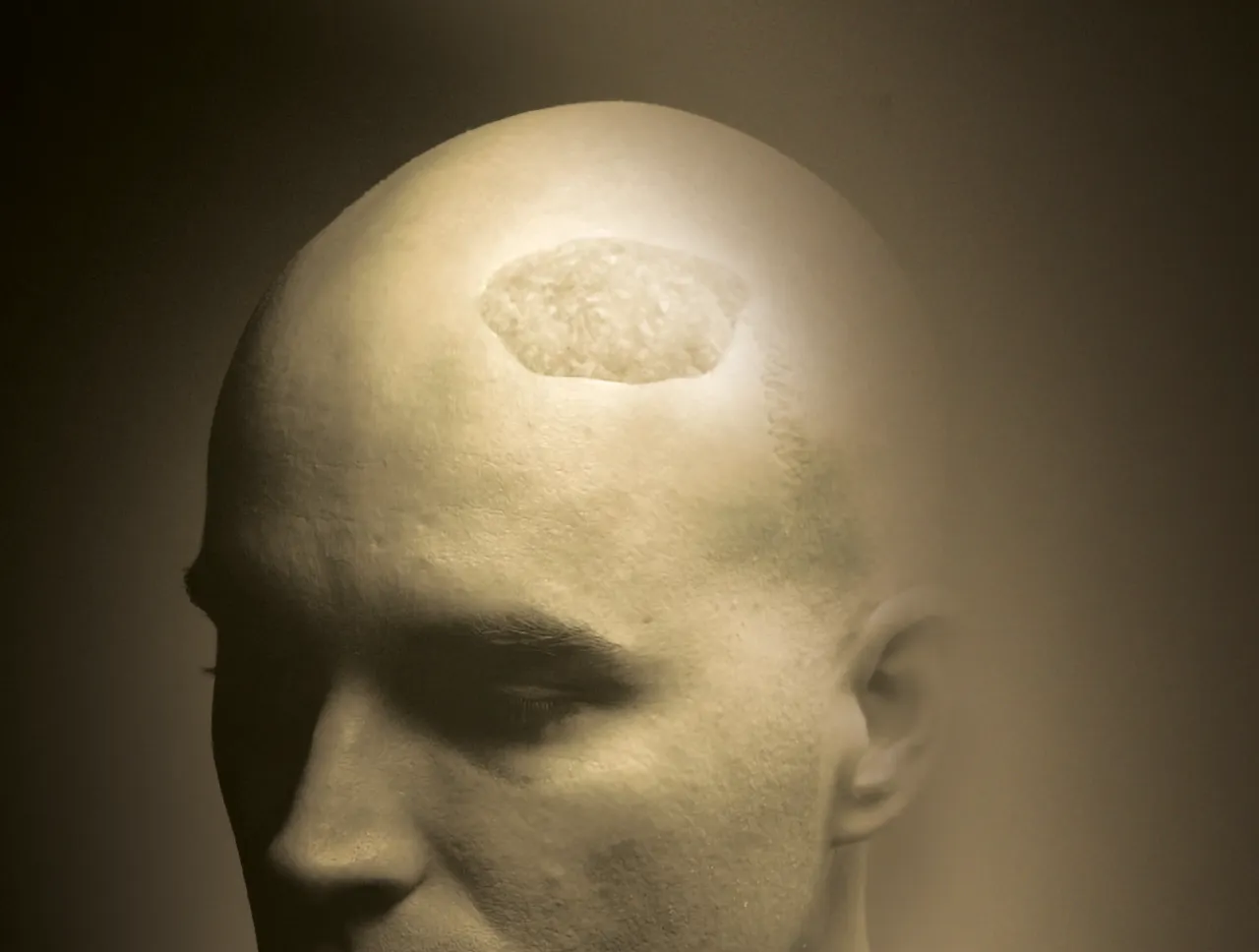 foto de material allogenix para matriz osea marca zimmer biomet colocado