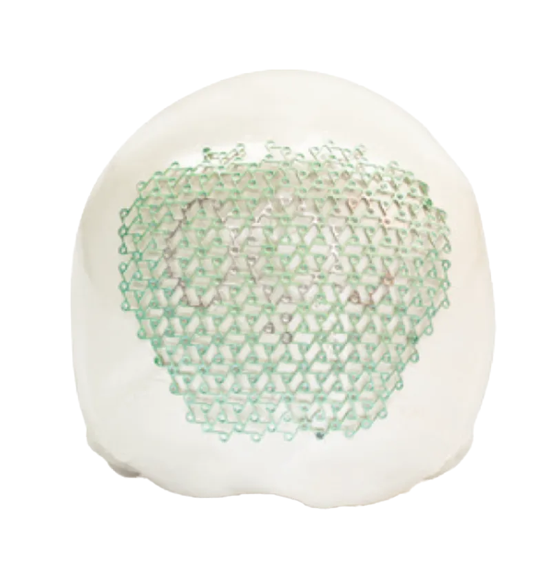 foto del sistema craniocurve para craeoplastia marca zimmer biomet